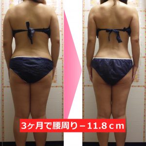 骨盤矯正ダイエット 骨盤の歪みを整え気になる脂肪にアプローチ